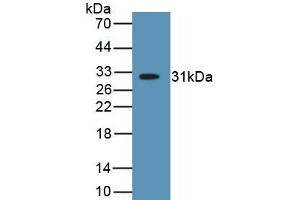 Detection of Recombinant MYH2, Human using Polyclonal Antibody to Myosin Heavy Chain 2 (MYH2) (MYH2 antibody  (AA 1237-1471))