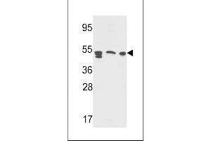 Western blot analysis in Y79,A2058,CEM cell line lysates(35ug/lane) (APCS antibody  (AA 285-314))