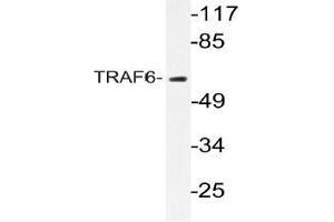 Western blot (WB) analyzes of TRAF6 antibody in extracts from HeLa cells. (TRAF6 antibody)