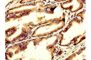 IHC image of ABIN7154533 diluted at 1:200 and staining in paraffin-embedded human prostate tissue performed on a Leica BondTM system. (GDF1 antibody  (AA 369-478))