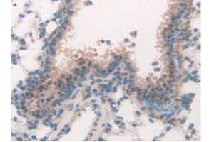 Detection of MAPK7 in Mouse Lung Tissue using Polyclonal Antibody to Mitogen Activated Protein Kinase 7 (MAPK7) (MAPK7 antibody  (AA 185-419))