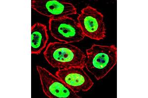 Immunofluorescence (IF) image for anti-Ewing Sarcoma Breakpoint Region 1 (EWSR1) antibody (ABIN3003929) (EWSR1 antibody)