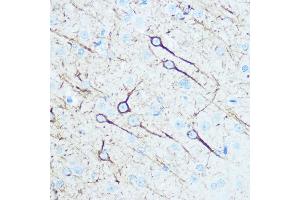 Immunohistochemistry of paraffin-embedded rat brain using Neurofilament M Rabbit pAb (ABIN7268865) at dilution of 1:100 (40x lens). (NEFM antibody  (AA 200-300))