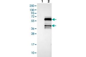 Western blot analysis of Lane 1: Negative control (vector only transfected HEK293T lysate), Lane 2: Over-expression Lysate (Co-expressed with a C-terminal myc-DDK tag (~3. (ICEF1 antibody)