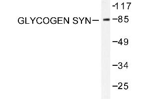 Image no. 1 for anti-Glycogen Synthase (GYS) antibody (ABIN265444) (Glycogen Synthase antibody)