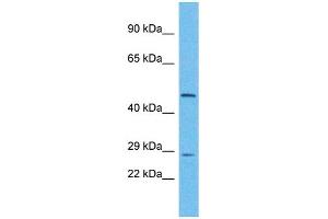 Host: Rabbit Target Name: UTP11L Sample Type: Hela Whole Cell lysates Antibody Dilution: 1. (UTP11L antibody  (N-Term))