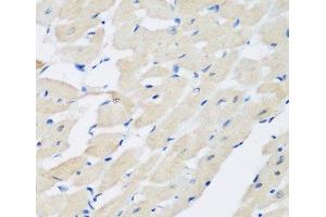Immunohistochemistry of paraffin-embedded Rat heart using PLEK Polyclonal Antibody at dilution of 1:200 (40x lens). (Pleckstrin antibody)