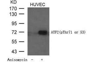 Western blot analysis of extracts from HUVEC cells untreated or treated with Anisomycin using ATF2 (Phospho-Thr71 or 53) Antibody. (ATF2 antibody  (pThr71))