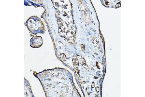 Immunohistochemistry of paraffin-embedded human placenta using CHRN Rabbit pAb (ABIN6133256, ABIN6138583, ABIN6138584 and ABIN6218660) at dilution of 1:100 (40x lens). (CHRNA7 antibody  (AA 23-230))