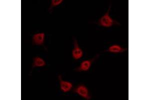 ABIN6274557 staining Hela by IF/ICC. (DYRK1B antibody  (Internal Region))