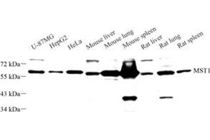 Western blot analysis of MST1 (ABIN7075561) at dilution of 1: 1000 (STK4 antibody)
