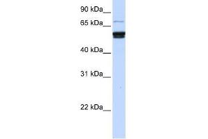 Western Blot showing ZNF93 antibody used at a concentration of 1-2 ug/ml to detect its target protein. (ZNF93 antibody  (N-Term))