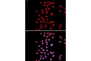 Immunofluorescence analysis of U2OS cells using DKC1 antibody (ABIN5970956). (DKC1 antibody)