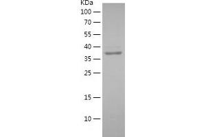 Western Blotting (WB) image for Myosin, Heavy Polypeptide 10, Non-Muscle (MYH10) (AA 1150-1450) protein (His tag) (ABIN7124070) (MYH10 Protein (AA 1150-1450) (His tag))