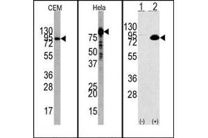 Image no. 1 for anti-Phosphoinositide 3 Kinase, p85 alpha (PI3K p85a) (N-Term) antibody (ABIN360455) (PIK3R1 antibody  (N-Term))