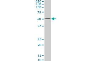 CSNK1G2 monoclonal antibody (M02), clone 2E6. (Casein Kinase 1 gamma 2 antibody  (AA 1-415))