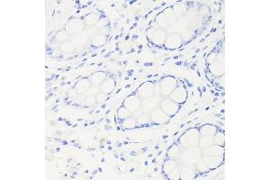 Immunohistochemistry (IHC) image for anti-Tumor Protein P53 (TP53) antibody (ABIN7271080)