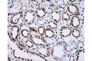 Immunohistochemical staining of paraffin-embedded Kidney tissue using anti-BTK mouse monoclonal antibody. (BTK antibody)