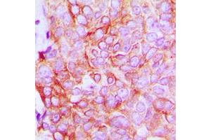 Immunohistochemistry (IHC) image for anti-Sodium Potassium ATPase, alpha1 (ATP1A1) (N-Term) antibody (ABIN7300384)