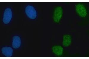 IF analysis of RAMP/ZMYM2 using anti-RAMP/ZMYM2 antibody (ABIN7602071).