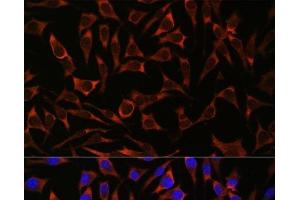 Immunofluorescence (IF) image for anti-Septin 8 (SEPT8) antibody (ABIN7258268)