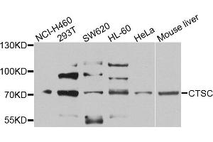 Western blot analysis of extracts of various cell lines, using CTSC antibody (ABIN5974676) at 1/1000 dilution.