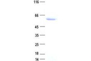 Western Blotting (WB) image for DNA (Cytosine-5-)-Methyltransferase 3 Like (TRDMT1) protein (DYKDDDDK Tag) (ABIN2719620)