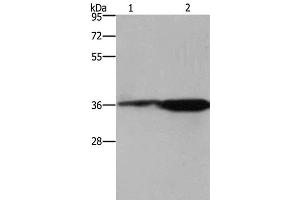 Western Blot analysis of 293T cell and Mouse brain tissue using CD89 Polyclonal Antibody at dilution of 1:550 (FCAR antibody)