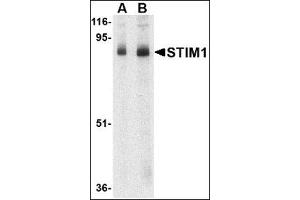Western blot analysis of STIM1 in mouse thymus tissue lysate with this product at (A) 1 and (B) 2 μg/ml. (STIM1 antibody  (C-Term))