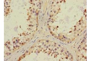 Immunohistochemistry of paraffin-embedded human testis tissue using ABIN7161348 at dilution of 1:100 (CHRNA6 antibody  (AA 26-239))