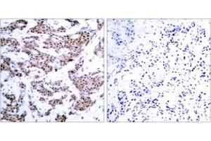 Immunohistochemistry (IHC) image for anti-Myocyte Enhancer Factor 2A (MEF2A) (AA 279-328), (pThr312) antibody (ABIN1531900)