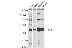 Western blot analysis of extracts of various cell lines, using HLA-E antibody (ABIN6128020, ABIN6141842, ABIN6141844 and ABIN6218491) at 1:1000 dilution. (HLA-E antibody  (AA 22-200))