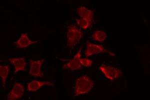 ABIN6267328 staining 293 by IF/ICC. (CSF1R antibody  (pTyr809))