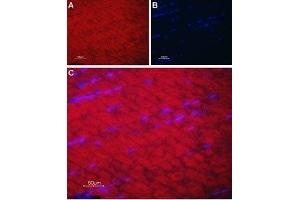 Expression of SERCA1 in rat skeletal muscle - Immunohistochemical staining of rat skeletal muscle paraffin-embedded sections using Anti-SERCA1 Antibody (ABIN7042953 and ABIN7044150), followed by goat anti-rabbit-AlexaFluor-594 secondary antibody. (ATP2A1/SERCA1 antibody  (Cytosolic))