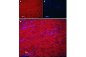 Expression of SERCA1 in rat skeletal muscle - Immunohistochemical staining of rat skeletal muscle paraffin-embedded sections using Anti-SERCA1 Antibody (ABIN7042953 and ABIN7044150), followed by goat anti-rabbit-AlexaFluor-594 secondary antibody. (ATP2A1/SERCA1 antibody  (Cytosolic, N-Term))