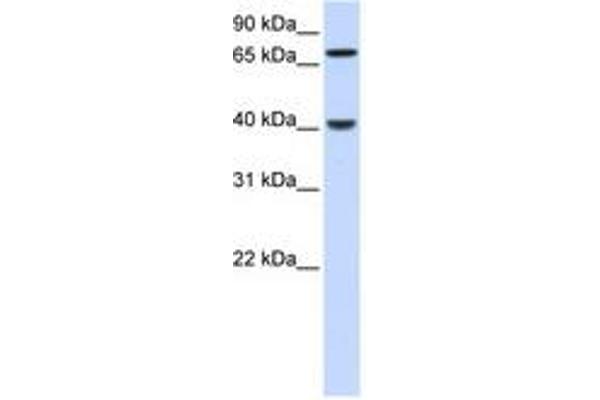 PDLIM3 antibody  (N-Term)