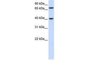 Image no. 1 for anti-PDZ and LIM Domain 3 (PDLIM3) (N-Term) antibody (ABIN6741278) (PDLIM3 antibody  (N-Term))