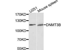 Western blot analysis of extracts of U251 and mouse spleen cells, using DNMT3B antibody.