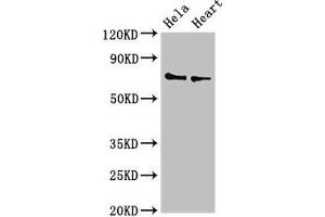 Western Blot Positive WB detected in: Hela whole cell lysate, Mouse heart tissue All lanes: PLS3 antibody at 3. (Plastin 3 antibody  (AA 310-455))