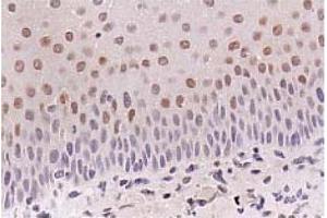 Immunohistochemistry (IHC) image for anti-Cyclin-Dependent Kinase Inhibitor 1A (p21, Cip1) (CDKN1A) antibody (ABIN487485) (p21 antibody)