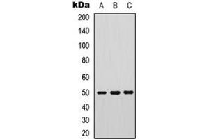 Western blot analysis of PTP1B (pS50) expression in COLO205 (A), human muscle (B), mouse heart (C) whole cell lysates. (PTPN1 antibody  (N-Term, pSer50))
