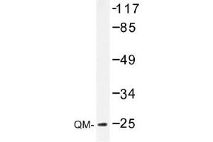 Image no. 1 for anti-Ribosomal Protein L10 (RPL10) antibody (ABIN317605)