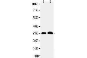 Anti-Aquaporin 5 antibody, Western blotting Lane 1: Rat Lung Tissue Lysate Lane 2: Rat Testis Tissue Lysate (Aquaporin 5 antibody  (C-Term))