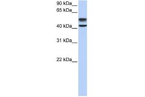 GNS antibody used at 1 ug/ml to detect target protein. (GNS antibody  (C-Term))