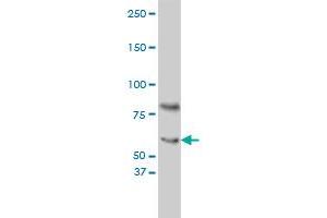 Western Blotting (WB) image for anti-Cryptochrome 1 (Photolyase-Like) (CRY1) (AA 1-586) antibody (ABIN560474)