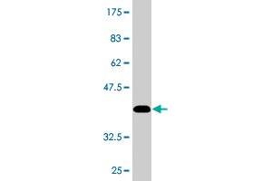 Western Blot detection against Immunogen (36. (DIAPH3 antibody  (AA 632-729))