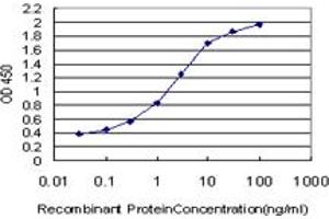 Detection limit for recombinant GST tagged RP2 is approximately 0. (RP2 antibody  (AA 251-350))