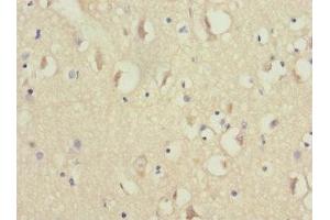 Immunohistochemistry of paraffin-embedded human brain tissue using ABIN7160945 at dilution of 1:100