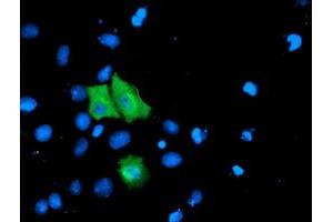 Anti-TOMM34 mouse monoclonal antibody (ABIN2454766) immunofluorescent staining of COS7 cells transiently transfected by pCMV6-ENTRY TOMM34 (RC201083). (TOMM34 antibody)