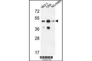 Western blot analysis in MCF-7,CEM,NCI-H460 cell line lysates (35ug/lane). (Sphingomyelin Synthase 2 antibody  (C-Term))